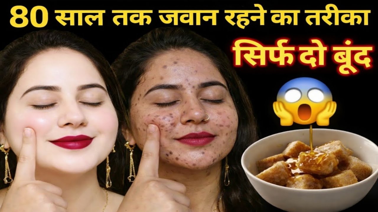 दो बूंद लगते ही मेरा चेहरा शीशे की तरह चमकने लगा👉10 साल पुरानी झाइयां काले दाग धब्बे सब साफ हो गए🙈