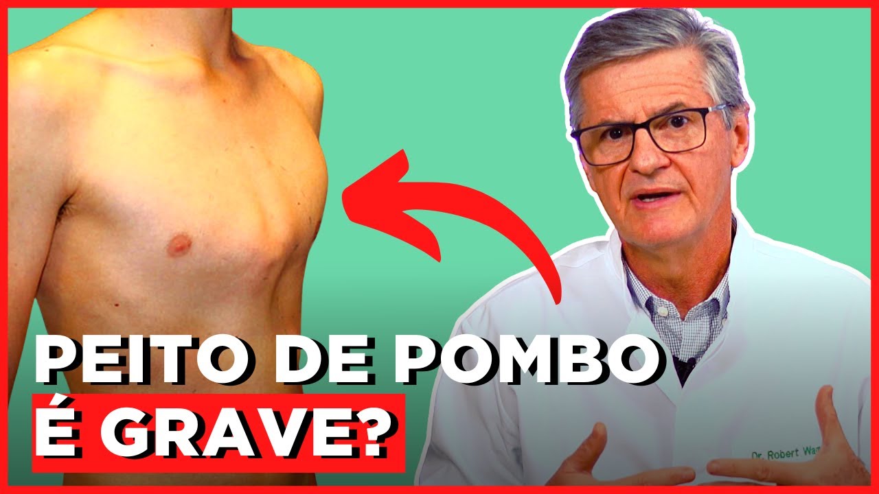Pectus (Peito de Pombo) Carinatum e Excavatum | Simplificando Ortopedia com Dr. Robert