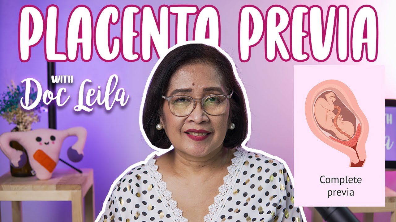 TUNGKOL SA PLACENTA PREVIA with Doc Leila, OB-GYN (Philippines)