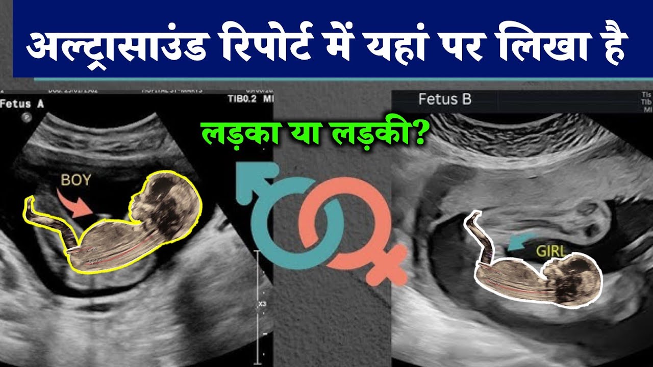 anomaly scan report boy or girl || how to know baby boy or girl in ultrasound reportboy or girl ||🤰🏼