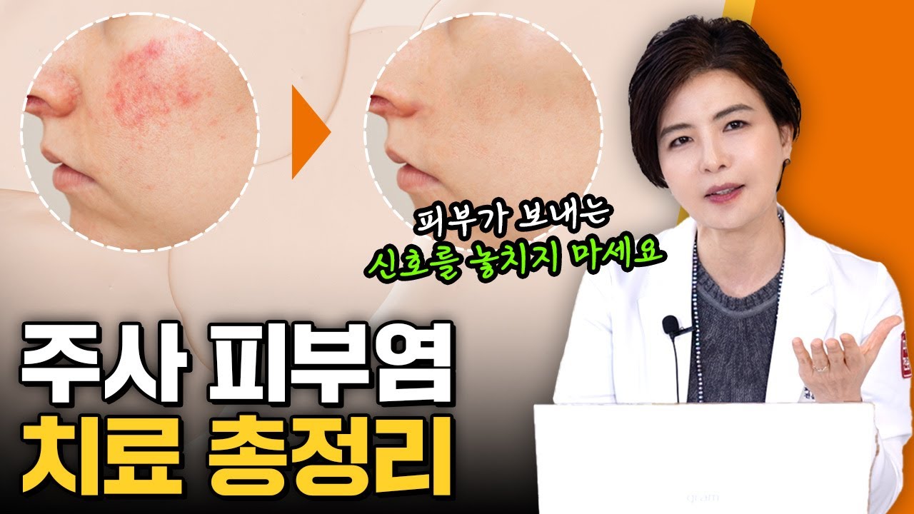 안면홍조, 주사 피부염 치료법은 이 영상 하나로 끝낼 수 있습니다!