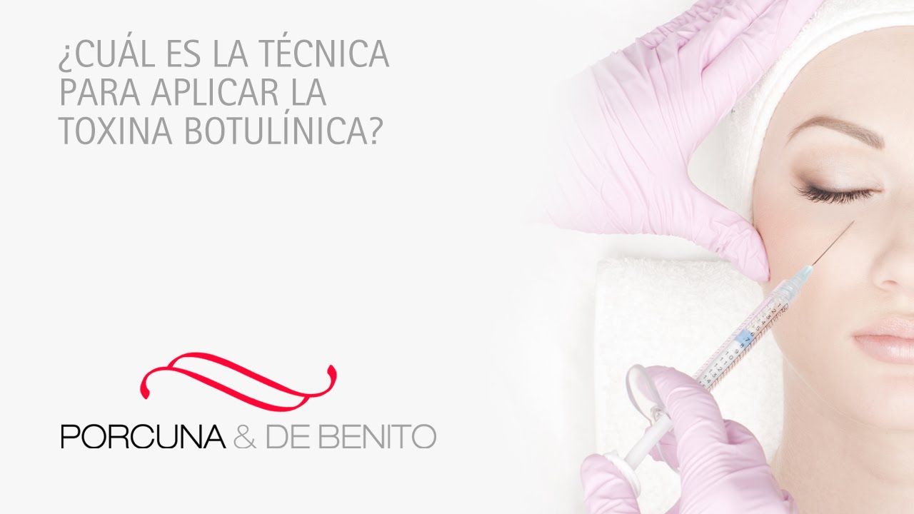 &iquest;Cu&aacute;l es la t&eacute;cnica para aplicar la toxina botul&iacute;nica?