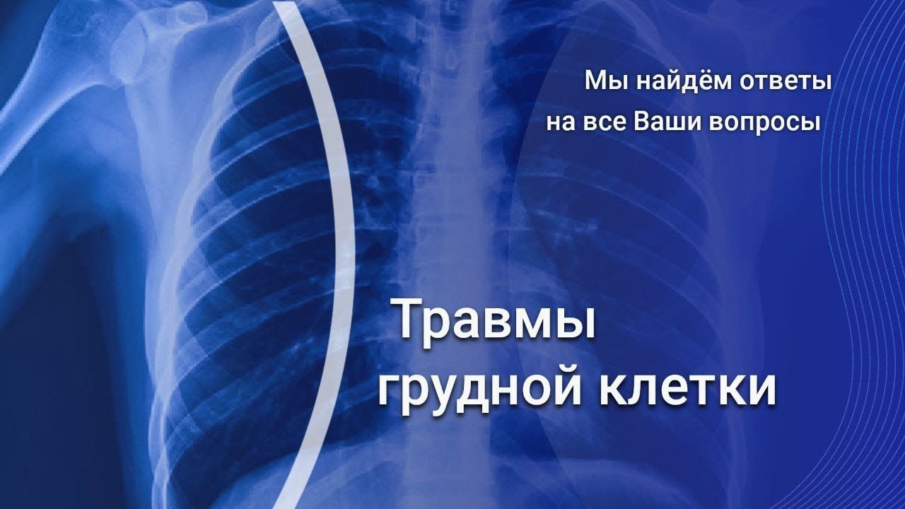 Взгляд рентгенолога: травмы грудной клетки.