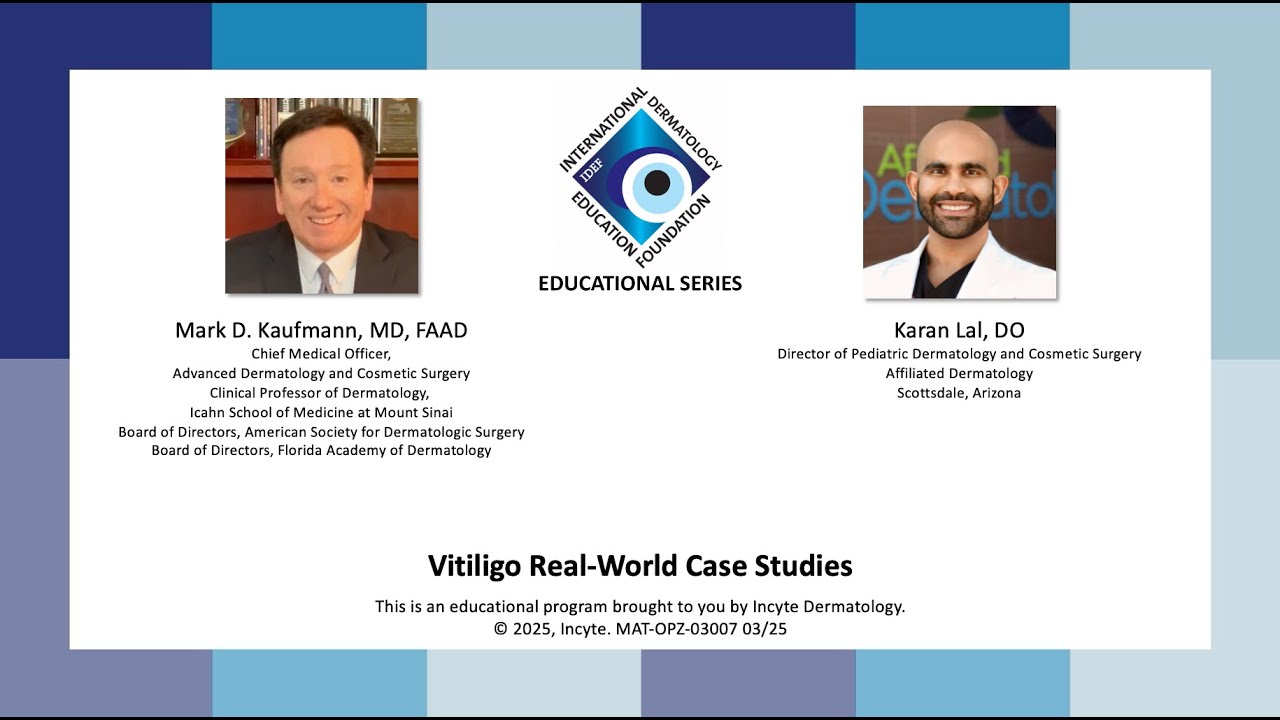 IDEF Educational Series  Vitiligo Real World Case Studies