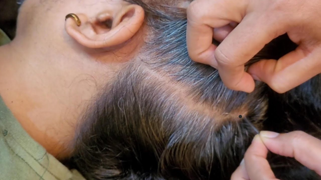 ASMR Scalp Treatment - Tingle Your Trouble Away