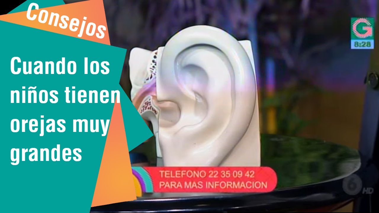 Cuando los ni&ntilde;os tienen orejas muy grandes | Consejos para usted