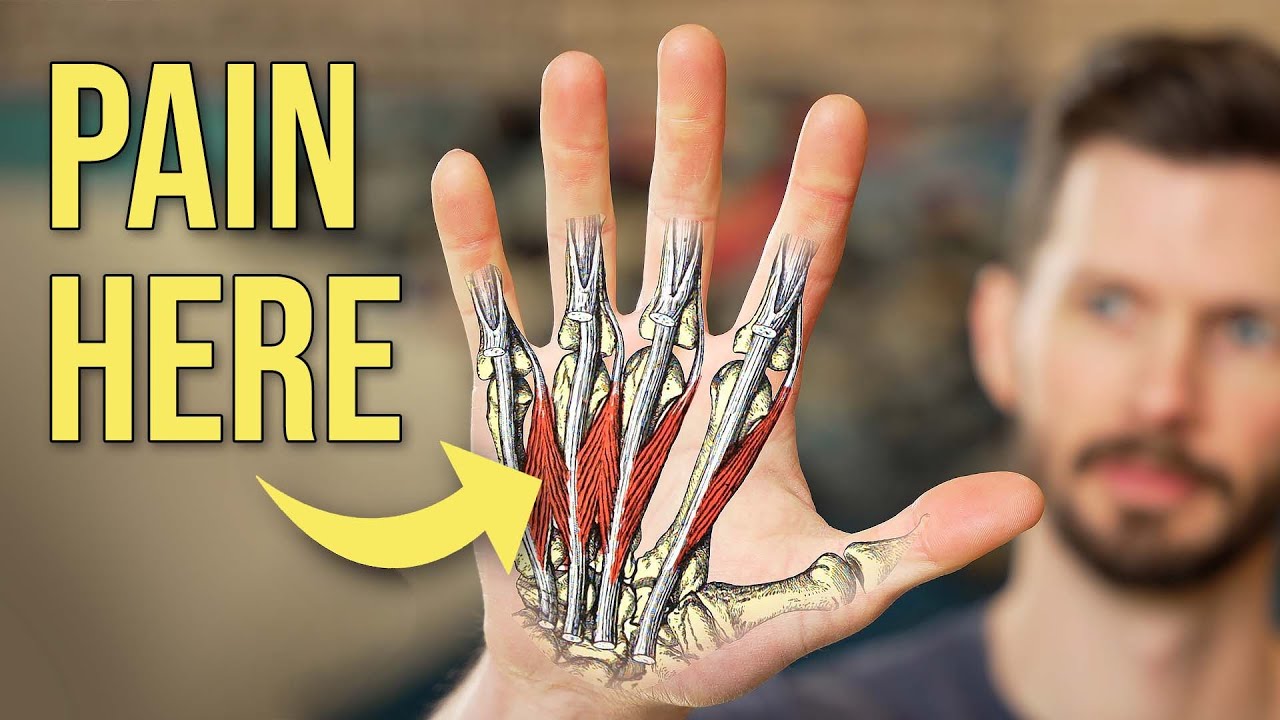 How to Fix Pain from Pocket Climbing & Three Finger Drag (Lumbrical Shift Syndrome)