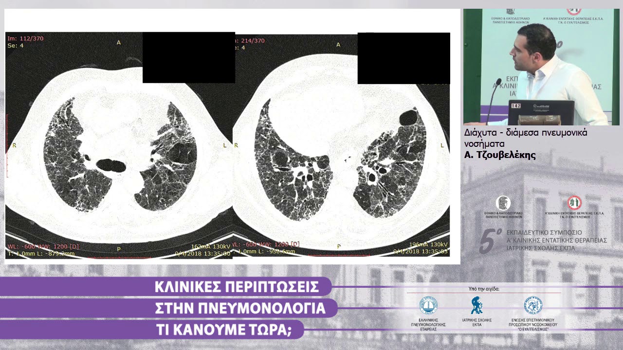 2019 05 11 1715 01 Tzouvelekis