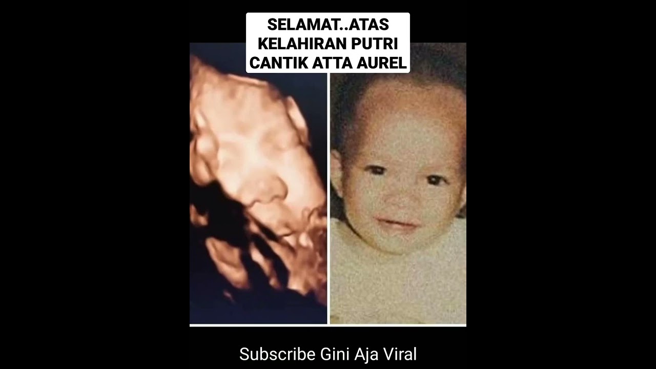 ATTA HALILINTAR AUREL MELAHIRKAN BAYI PEREMPUAN PUTRI CANTIK AHHA