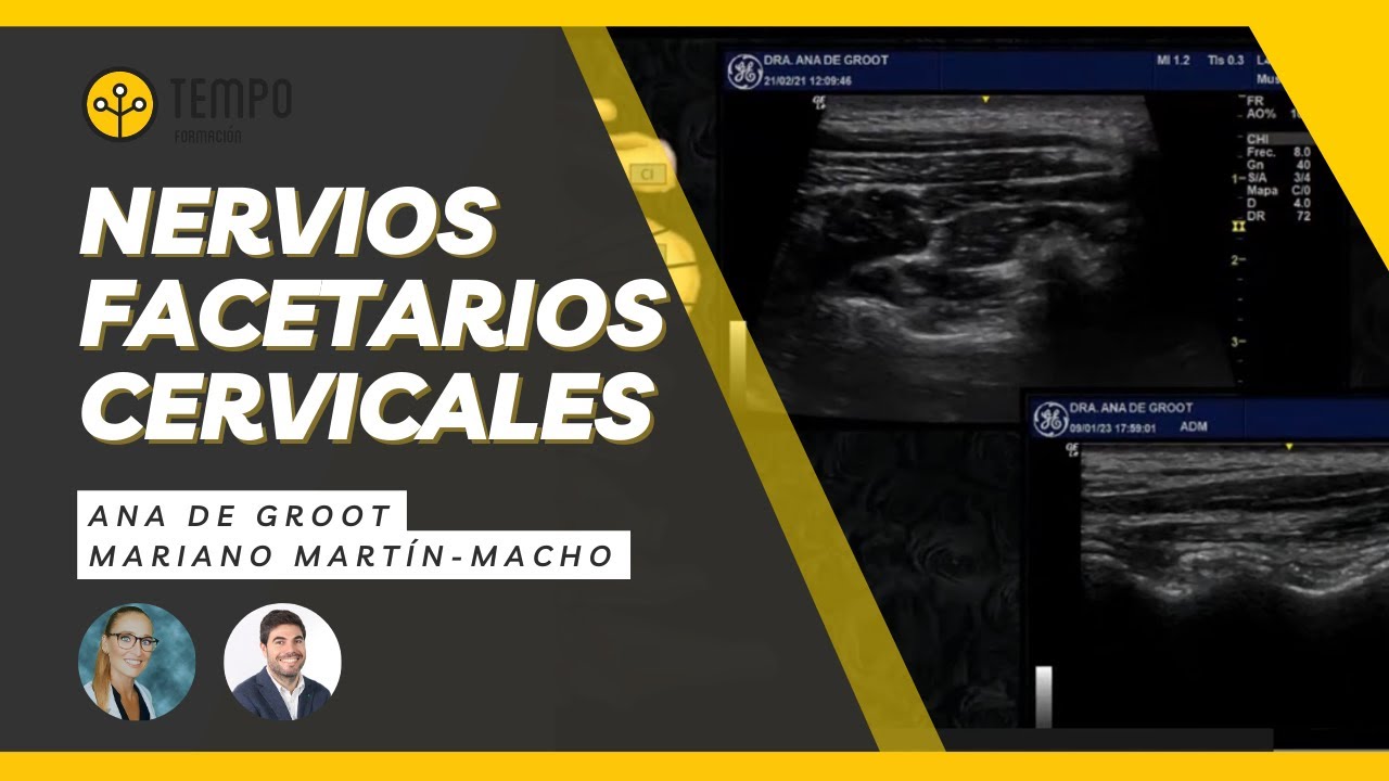 Nervios facetarios cervicales con Ana de Groot y Mariano Martín-Macho #ecografia #tempoformacion