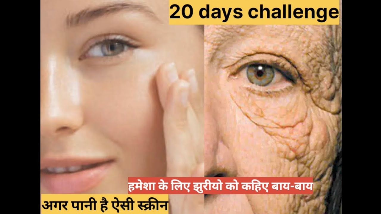 सिर्फ 20 दिन का challenge अगर पानी है ऐसी स्किन झुरी को कहिए हमेशा के लिए बाय-बाय|