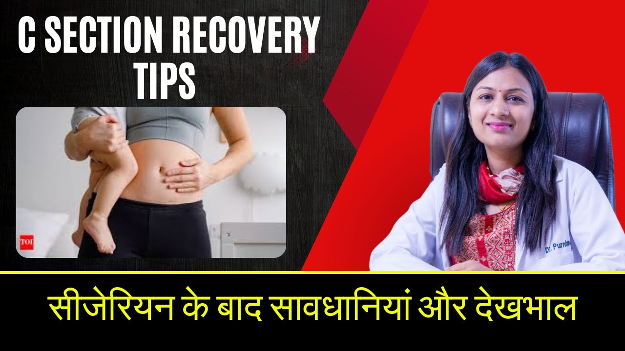 सीजेरियन डिलीवरी के बाद रिकवरी के तरीके और सावधानियां | C Section Recovery Tips After Delivery !