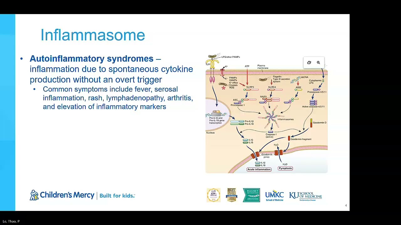 Evaluation of Recurrent Fevers (Raje/Le)