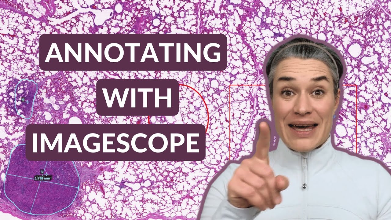 Aperio ImageScope | Bezpłatne narzędzie do adnotacji w patologii