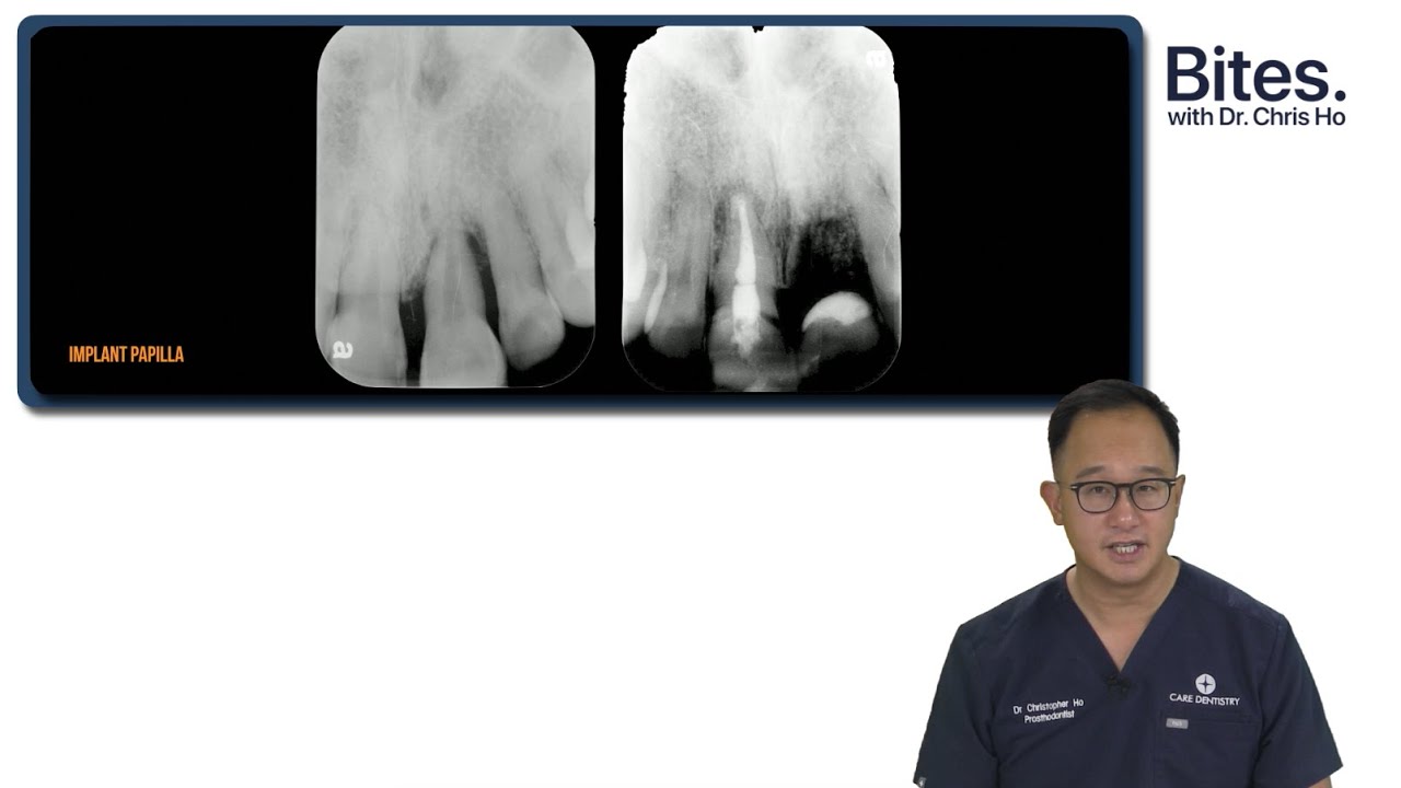 Pink Aesthetics & The Papilla | Bites by Dr Chris (EP9)