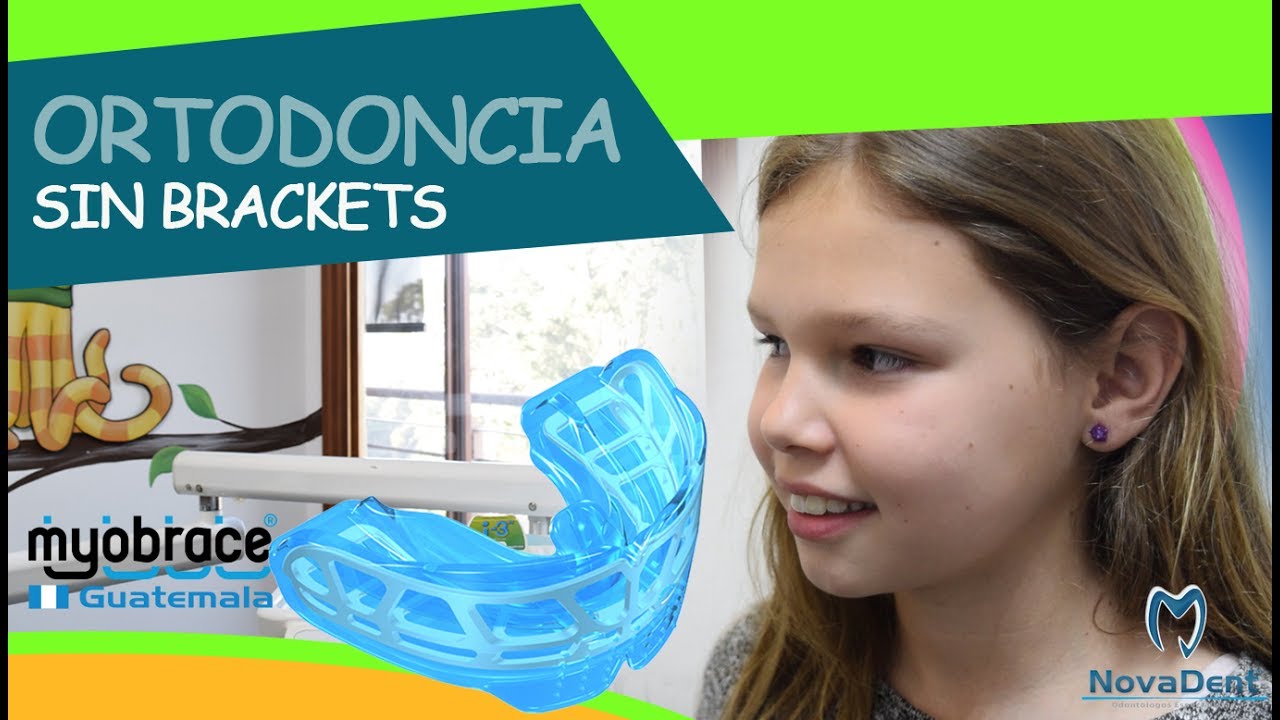 90% menos Brackets - La ortodoncia tradicional quedo atras... Novadent - Myobrace  Guatemala