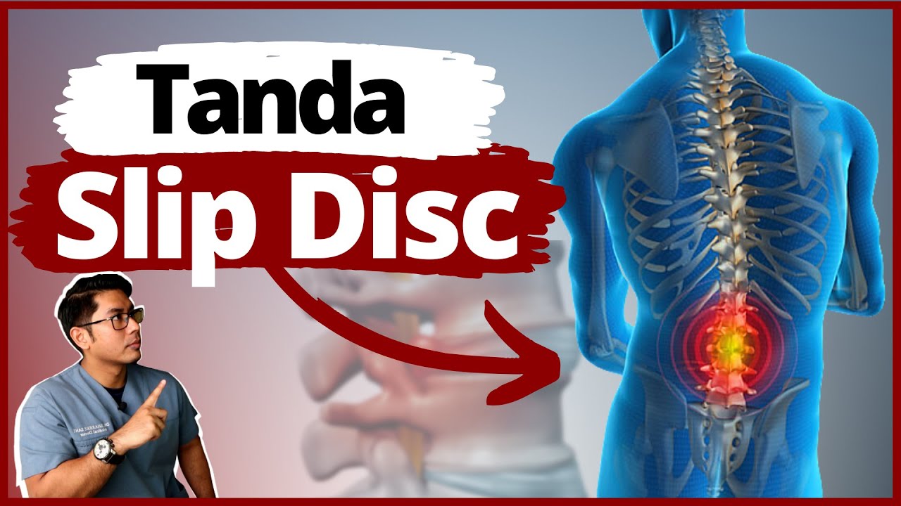 Sakit Belakang | 5 Tanda Slip Disc Wajib Tahu | Doctor Sani |