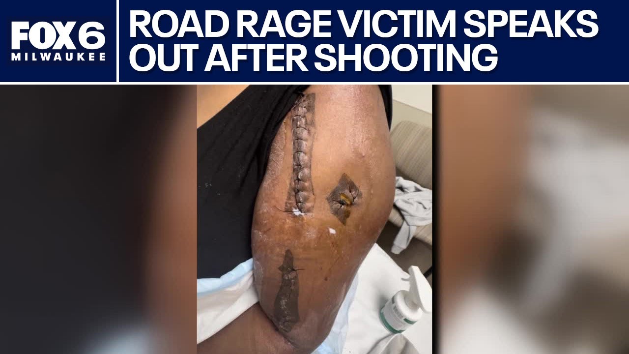 Milwaukee road rage shooting victim speaks out | FOX6 News Milwaukee