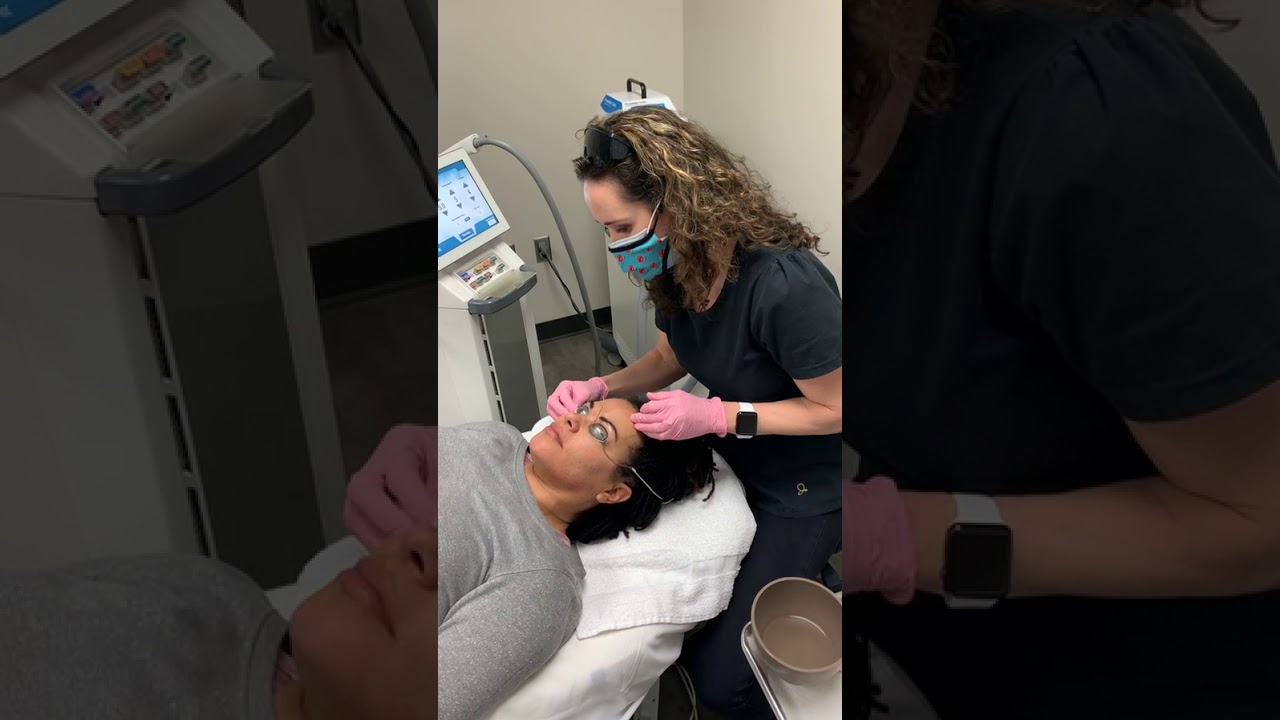 Watch a Moxi Laser Treatment with Kathy Taranto at AesthetiCare Medspa