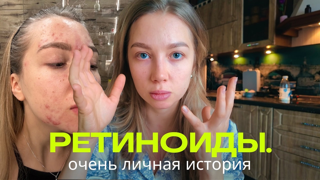 Таблетка от прыщей / Как я вылечила АКНЕ? / Побочки, к которым я не была готова