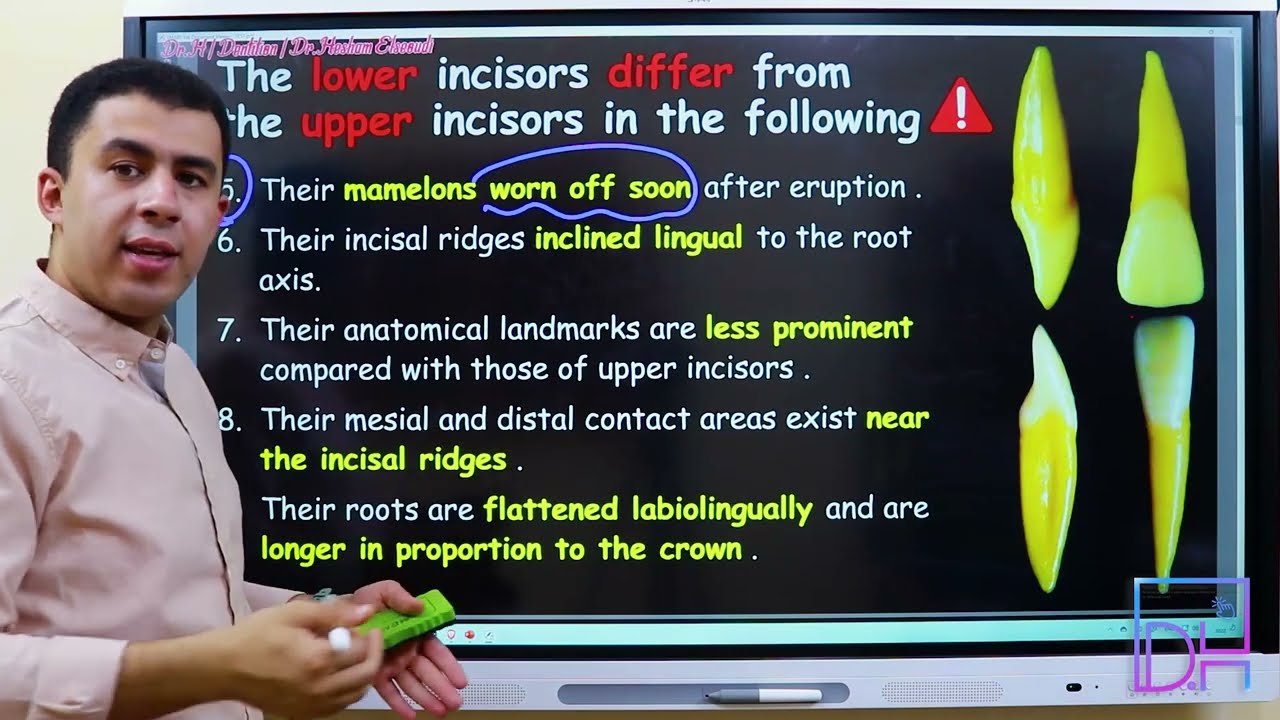 19- Mandibular Permanent Cental Incisor