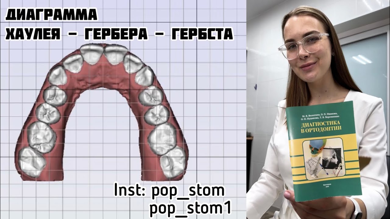Диаграмма Хаулея - Гербера - Гербста
