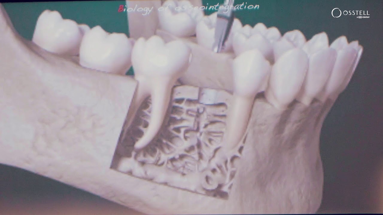 Biological process of osseointegration