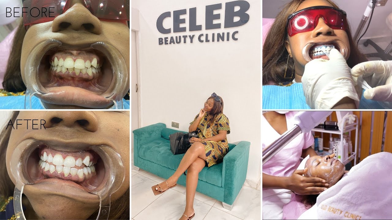 GETTING MY TEETH WHITENED IN IBADAN | FACIALS| PAMPER VLOG| CELEB BEAUTY CLINIC