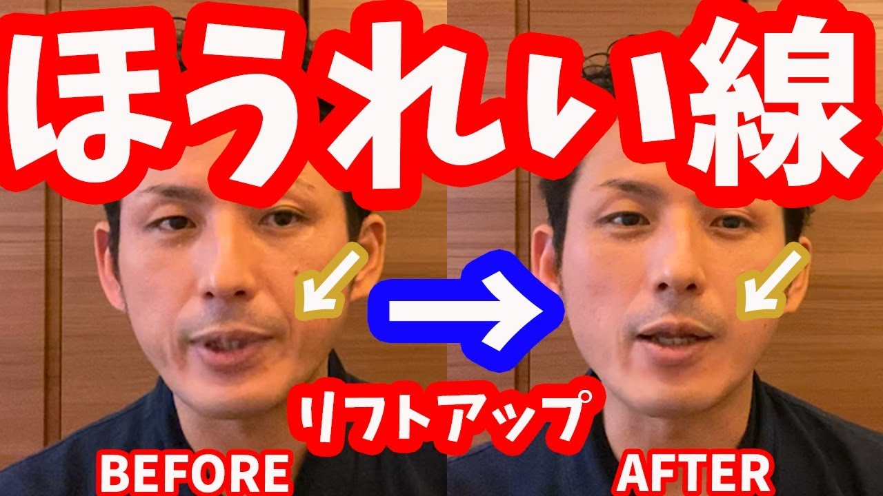 【初公開】ほうれい線・リフトアップに効く「側頭筋リリース」【大分市 腰痛治療家 GENRYU ( 安部元隆 )】Reduce the laugh lines with GENRYU's METHOD
