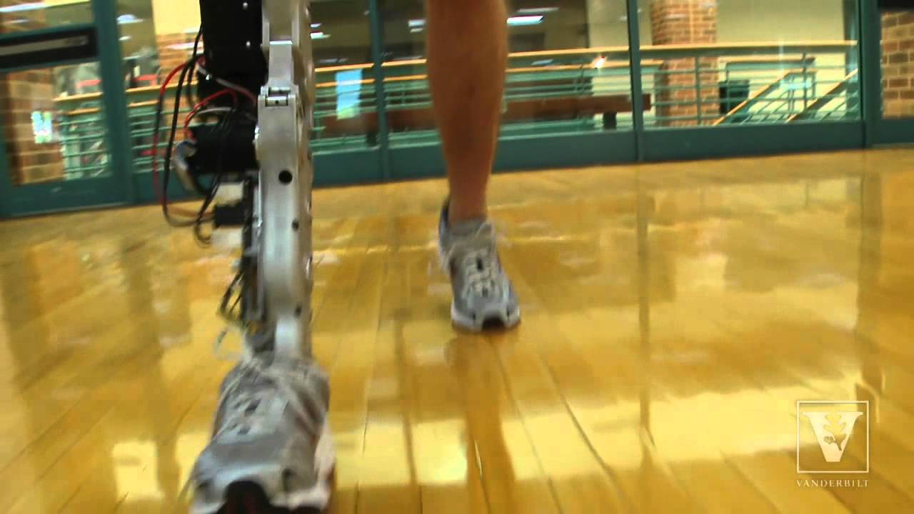 New 'bionic' leg gives amputees a natural gait