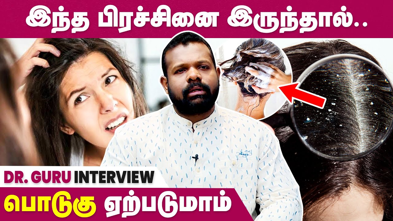 Reasons & Remedies For Hair Dandruff | Dr. Guru Interview
