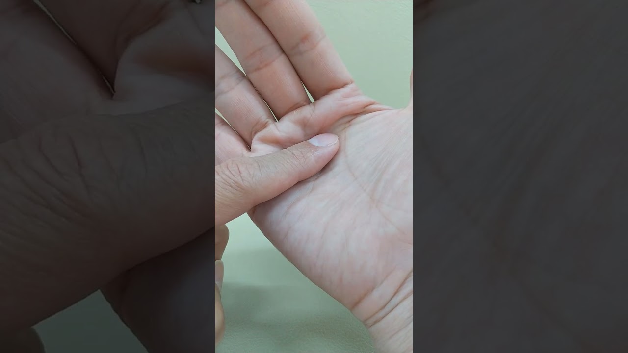 この指の痛みはばね指なのか！？ snapping finger　弾発指　春日部　ときだ接骨院鍼灸院