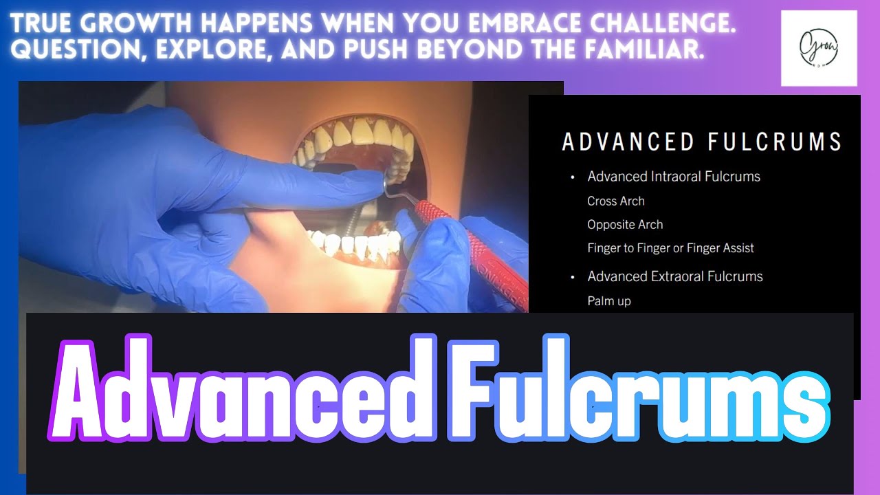 Mastering Advanced Fulcrums for Precision Instrumentation | 5 Essential Techniques
