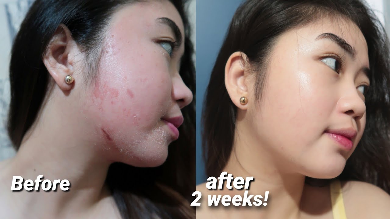 KOREAN GLASS SKIN ACHIEVED IN JUST 2 WEEKS! 😱 | Camille Romero