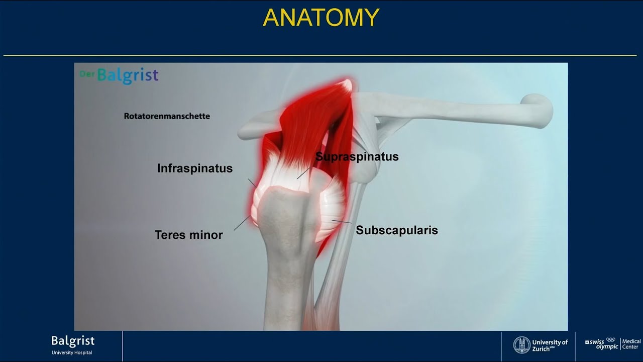 Balgrist erkl&auml;rt: Reparable Rotatorenmanschettenruptur | Reparable Rotator Cuff Tear