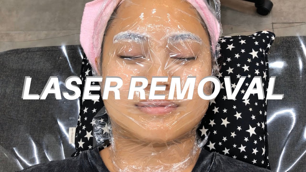I had to get my eyebrows removed!