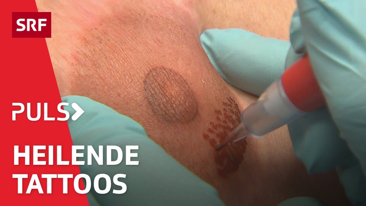 Tattoos können schmerzen, aber auch heilen: Die unsichtbare Kraft des Körperschmucks | Puls | SRF