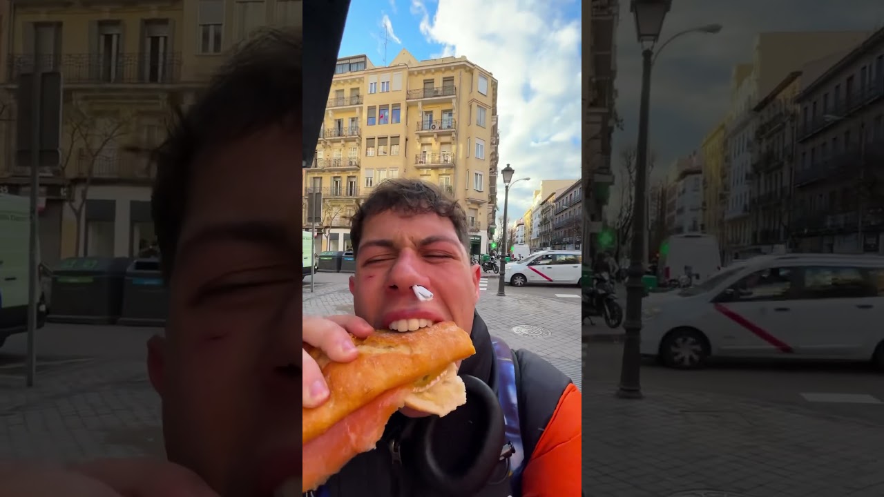 Como me han dejado la cara niño, 