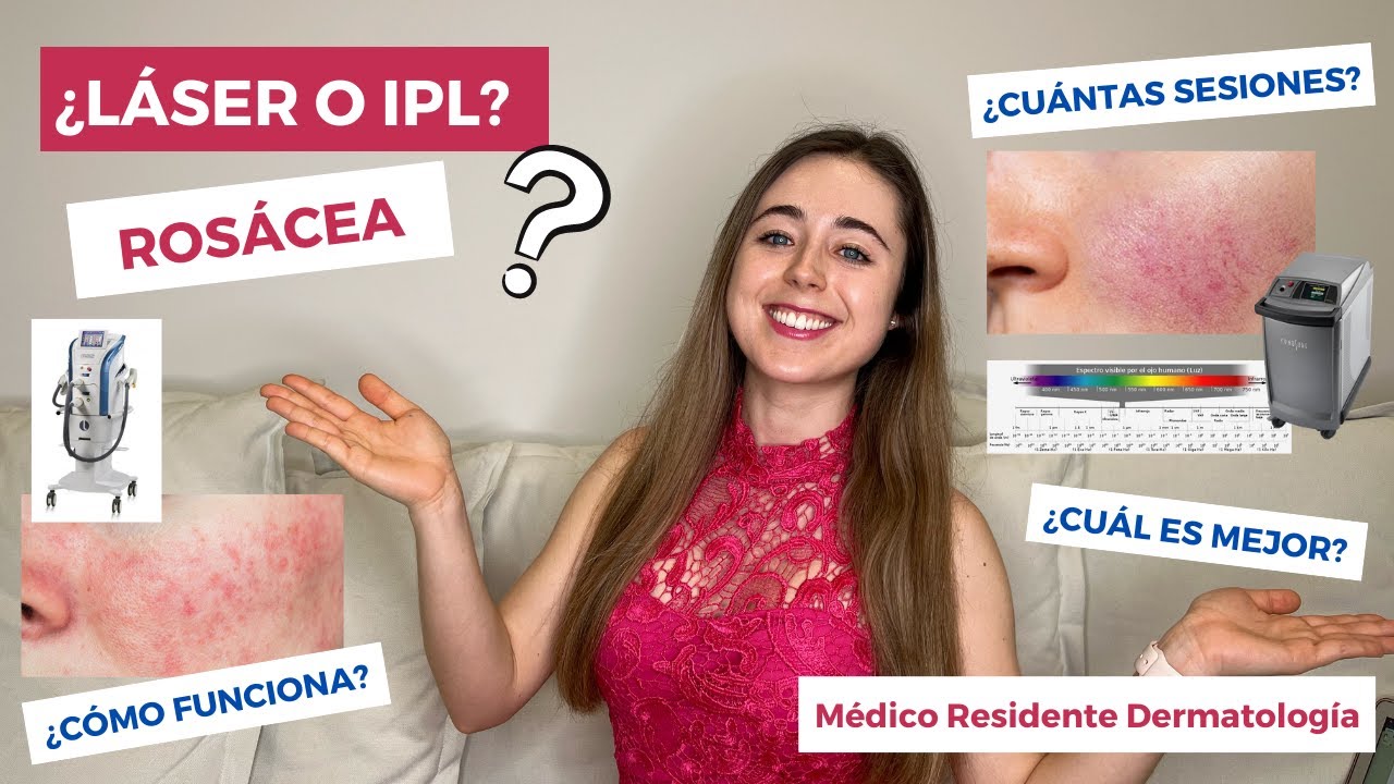 TRATAMIENTO LÁSER E IPL PARA ROSÁCEA ¿CÓMO FUNCIONA? ¿CUÁL ES MEJOR? CUPEROSIS, TELANGIECTASIAS