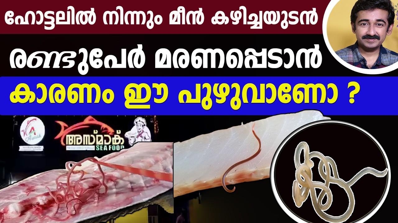 ഹോട്ടലിൽ നിന്നും മീൻ കഴിച്ചയുടൻ രണ്ടുപേർ മരണപ്പെടാൻ കാരണം ഈ പുഴുവാണോ ?