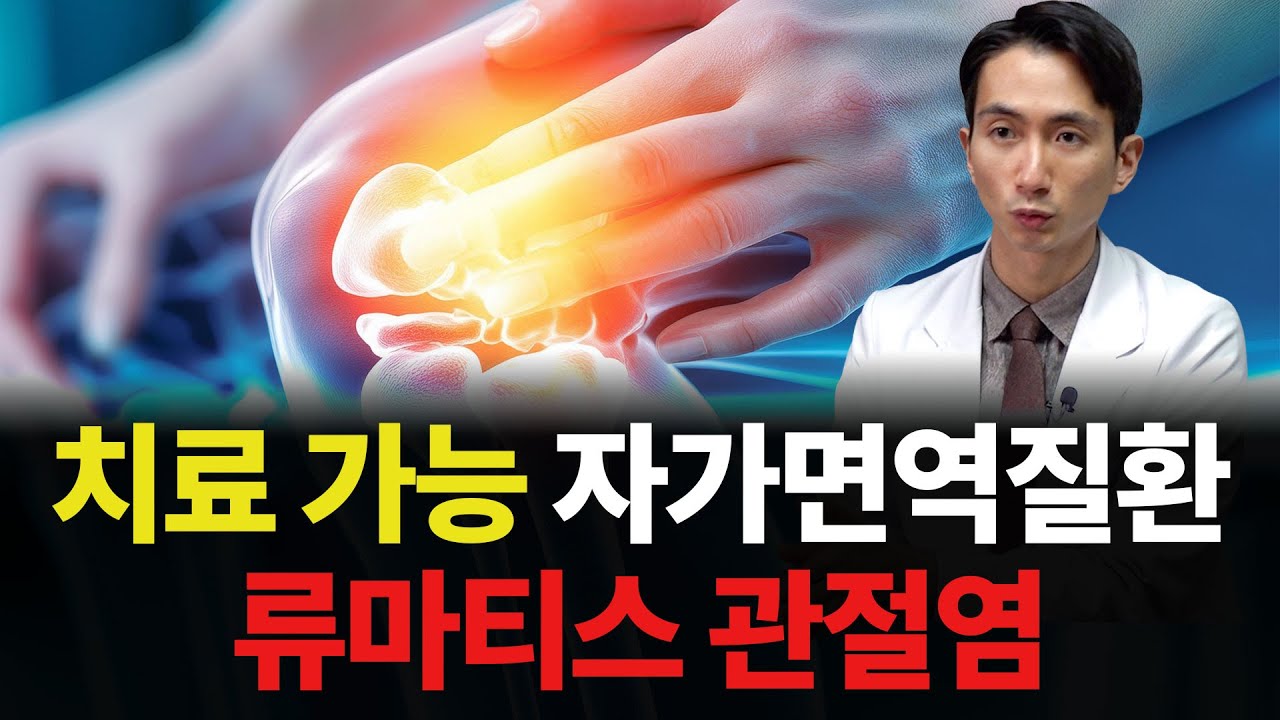 류마티스 관절염 증상 이해와 치료, 이렇게 관리하자