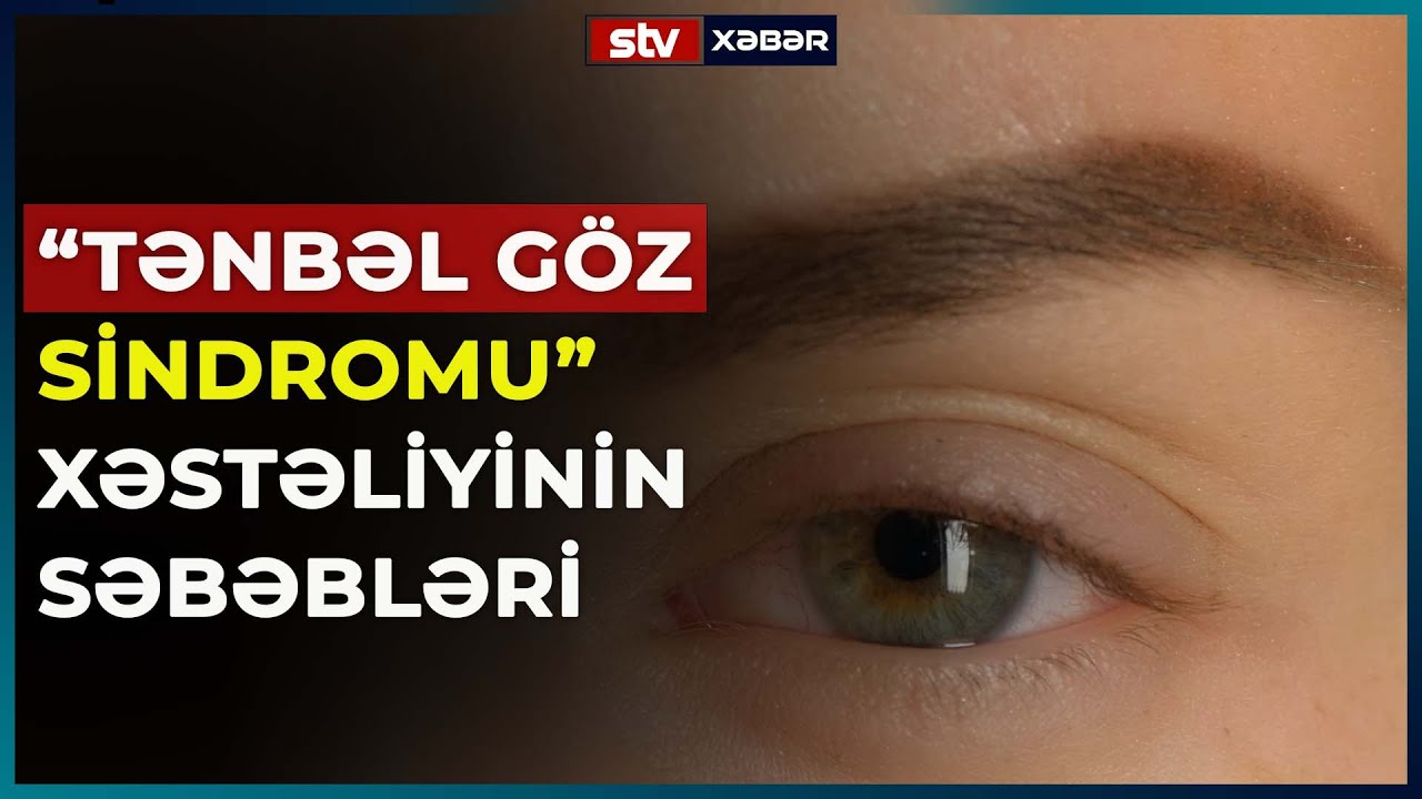 “TƏNBƏL GÖZ SİNDROMU” XƏSTƏLİYİNİN SƏBƏBLƏRİ - STV XƏBƏR