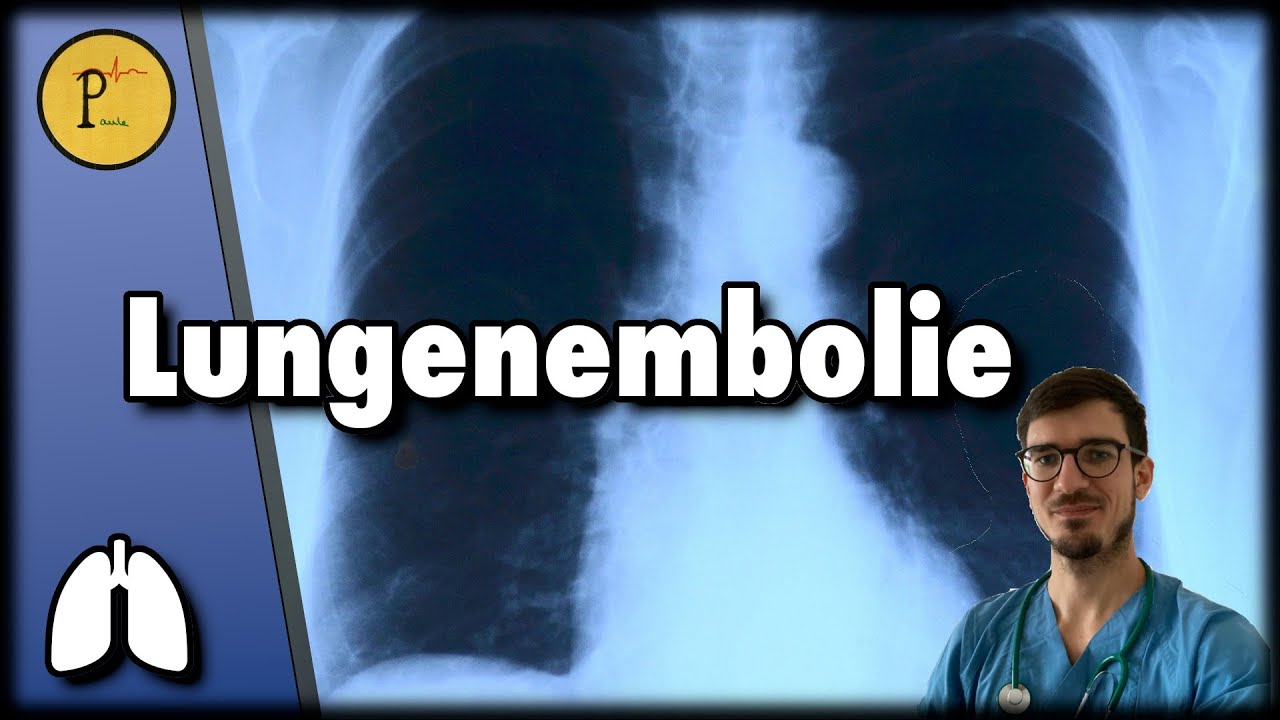 Lungenembolie erklärt. Wenn dir plötzlich die Luft wegbleibt.