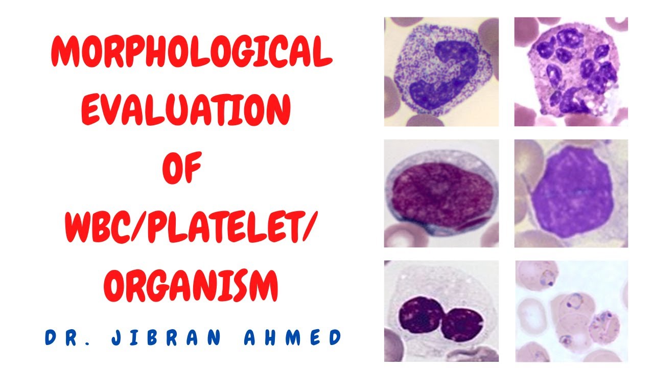 MORPHOLOGICAL EVALUATION OF WBCs/PLATELETS/ORGANISM  II PRACTICAL PATHOLOGY II  @DR. JIBRAN AHMED