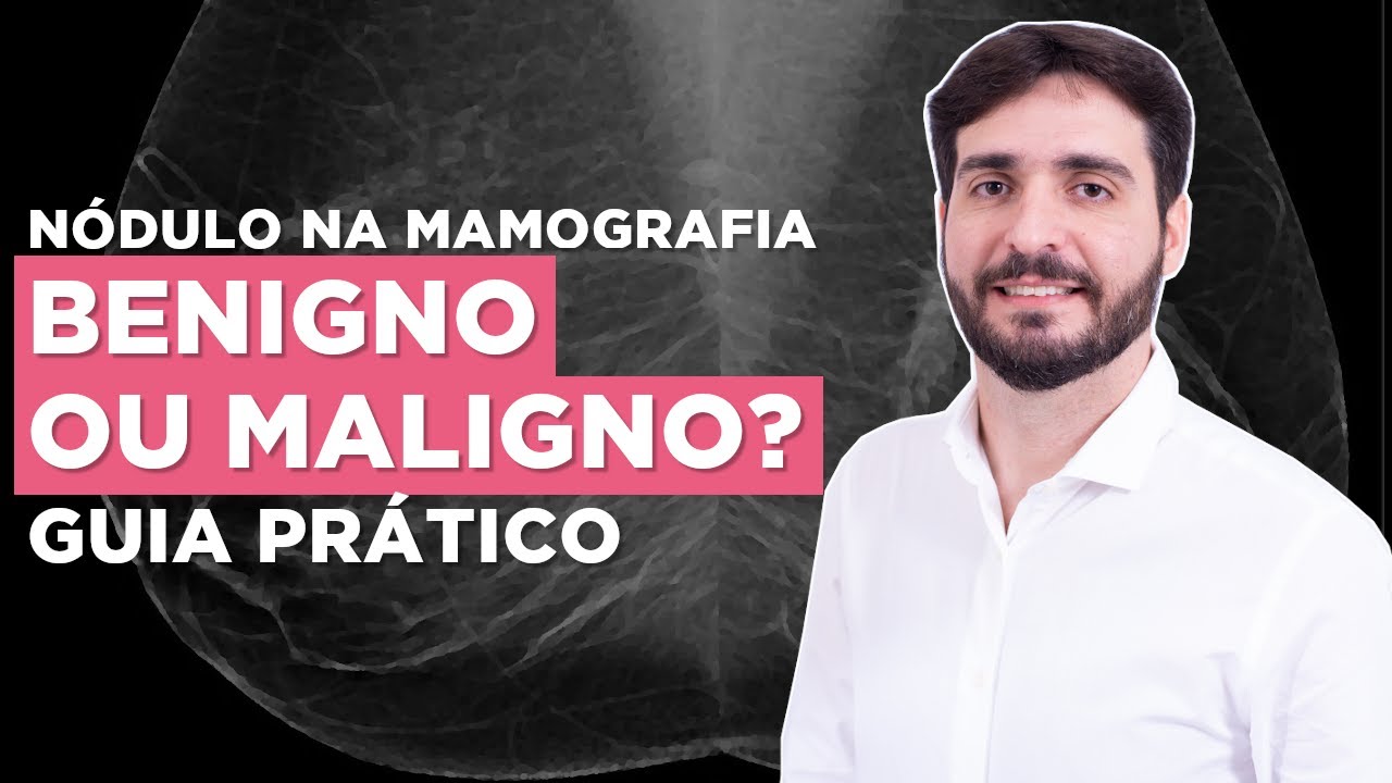 Os 5 padrões de imagem na mamografia que você não pode errar | Galvani Filho