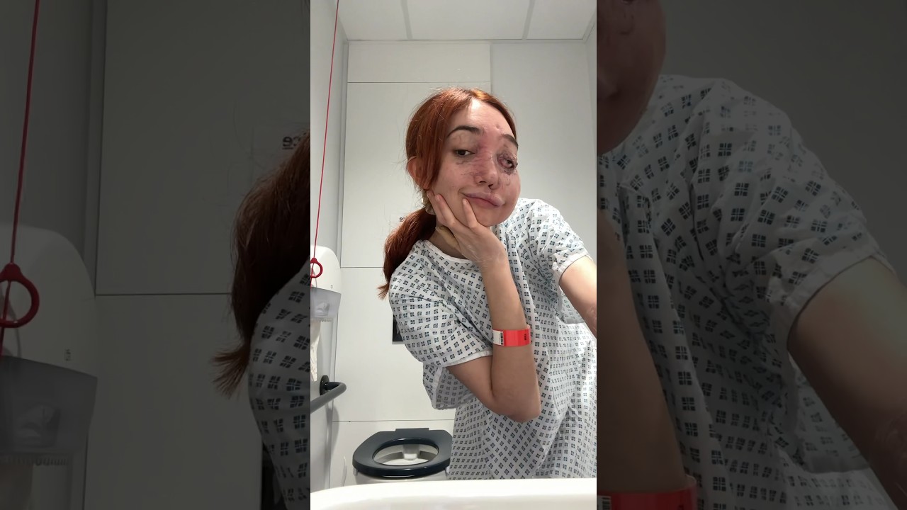 come with me to have an operation (again) #shorts