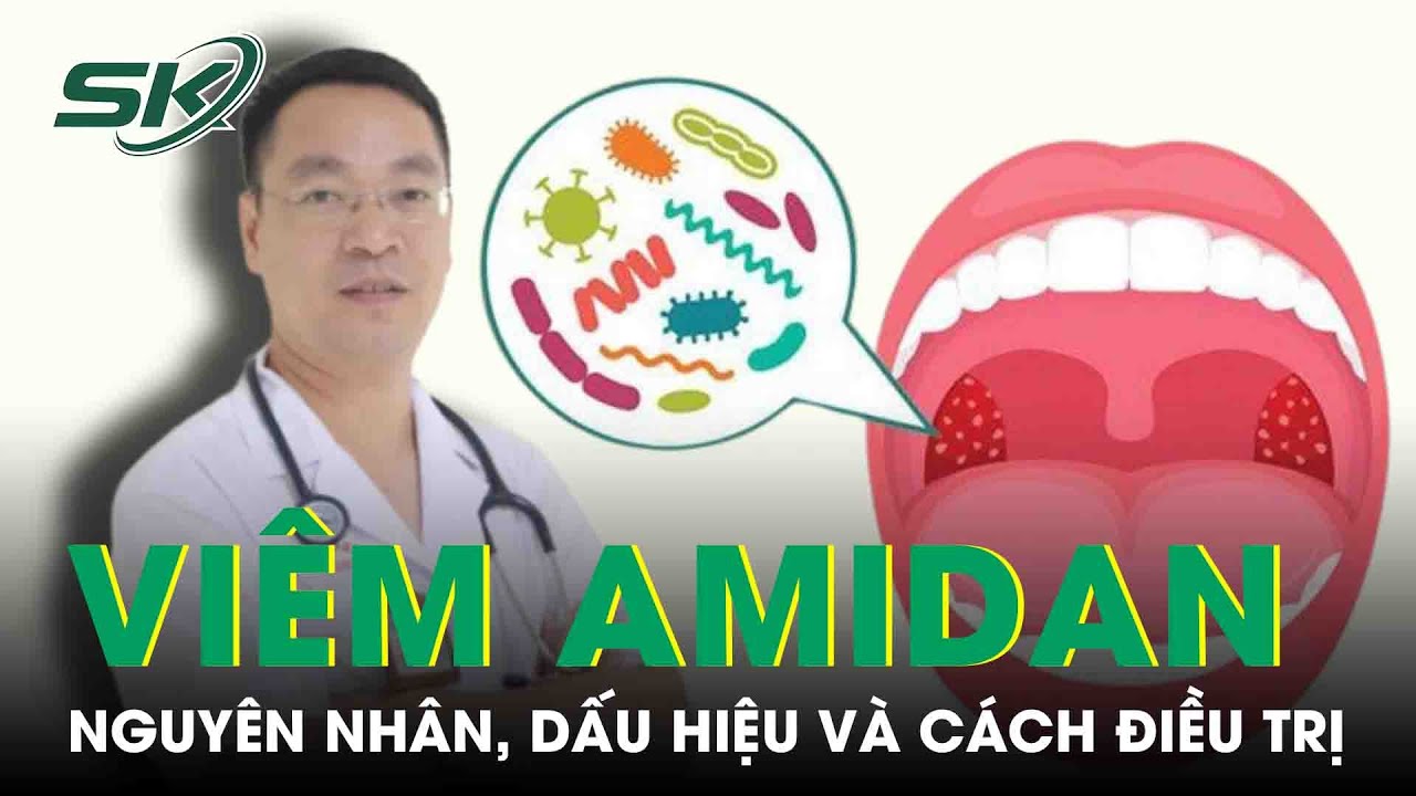 Bệnh viêm amidan: Nguyên nhân, dấu hiệu và cách điều trị | SKĐS