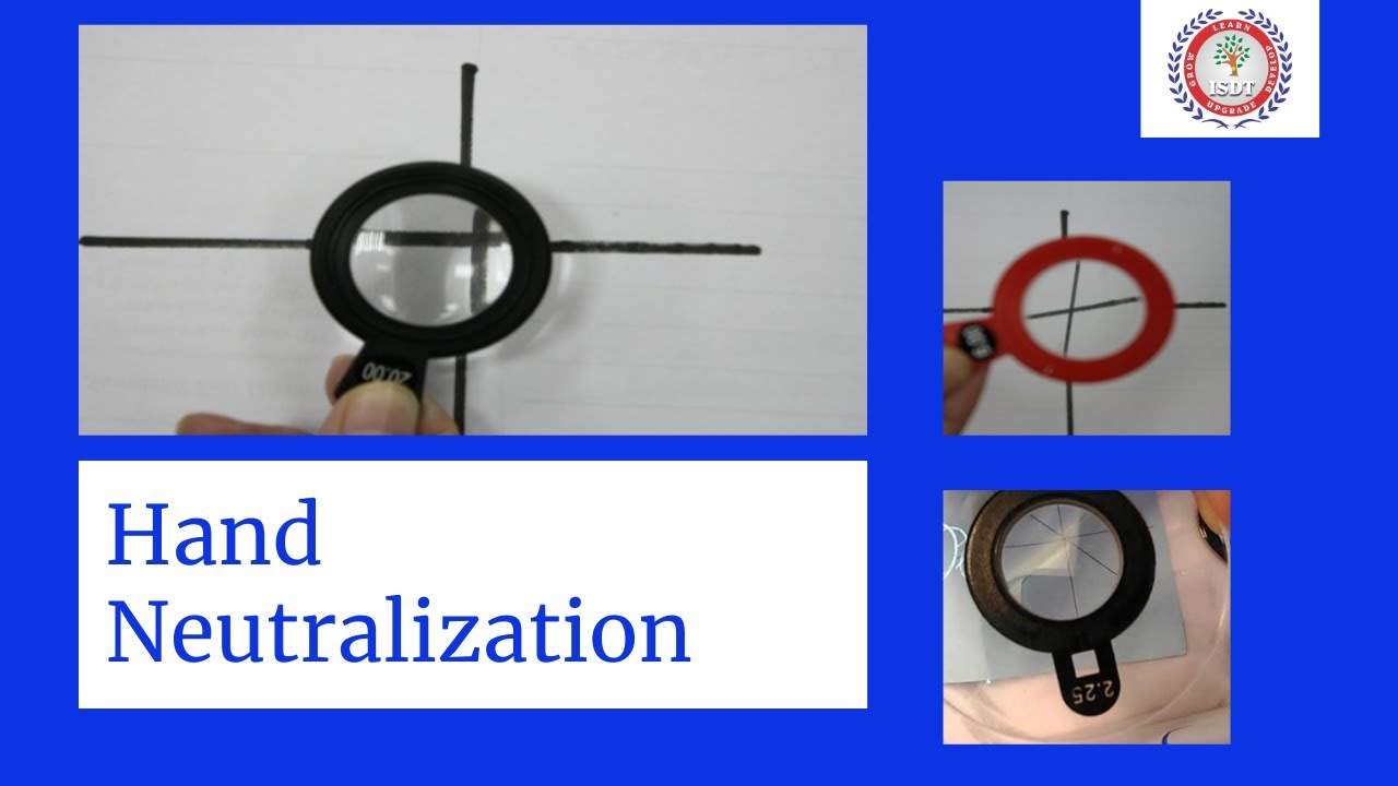 Hand Neutralization | ISDT | CDO | NSDC