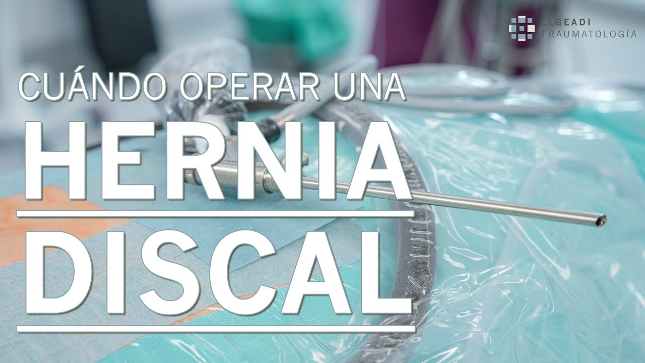 🌟 ¿Cuándo operar una HERNIA DISCAL?🌟