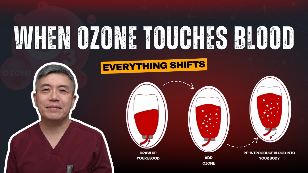 Ozone Therapy Explained: How Extracorporeal Blood Ozonation Really Works (Science-Based)